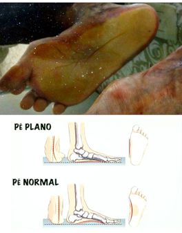 Podoposturologia